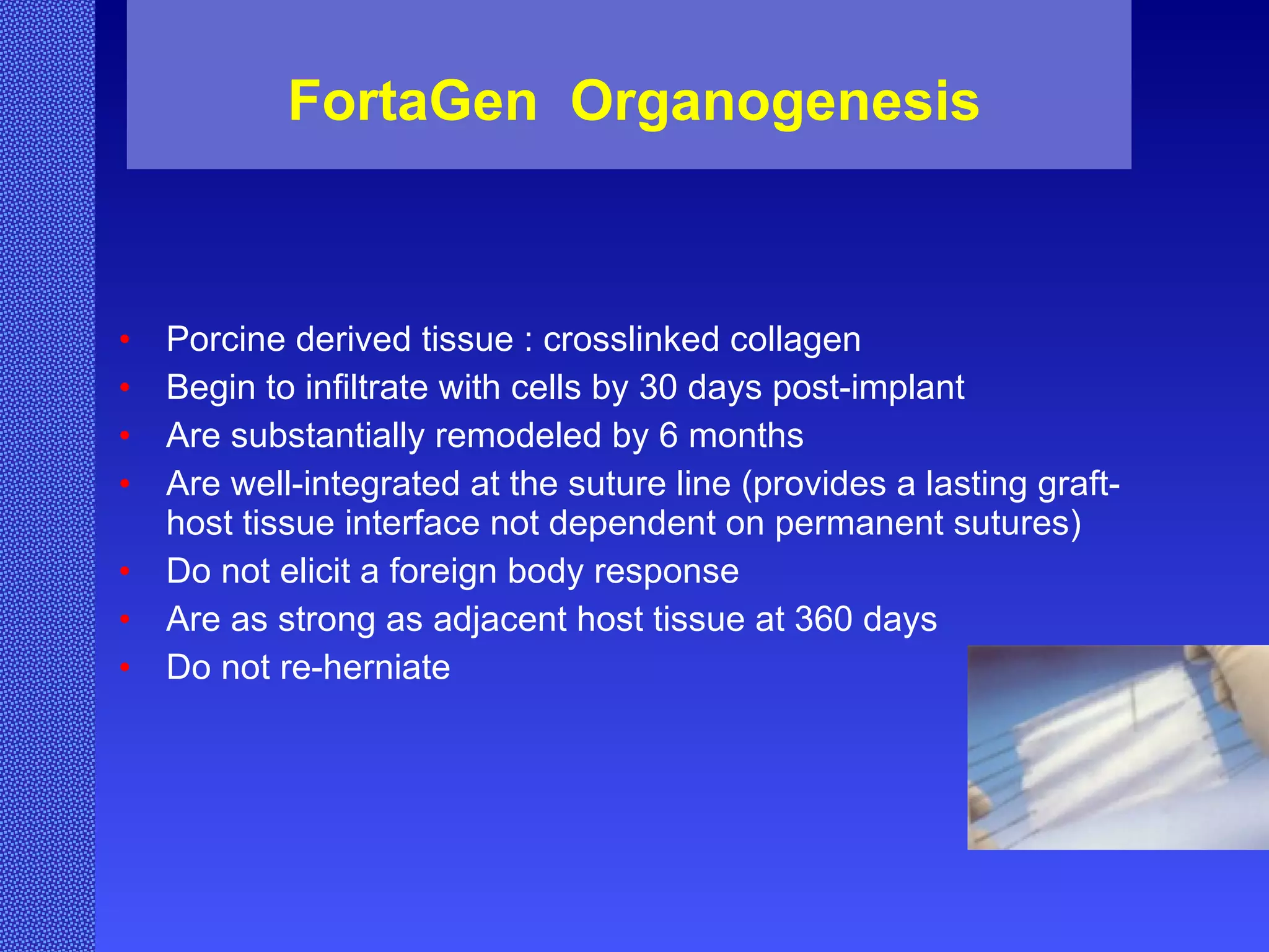 FortaGen  Organogenesis Porcine derived tissue : crosslinked collagen Begin to infiltrate with cells by 30 days post-implant Are substantially remodeled by 6 months Are well-integrated at the suture line (provides a lasting graft-host tissue interface not dependent on permanent sutures) Do not elicit a foreign body response Are as strong as adjacent host tissue at 360 days Do not re-herniate 