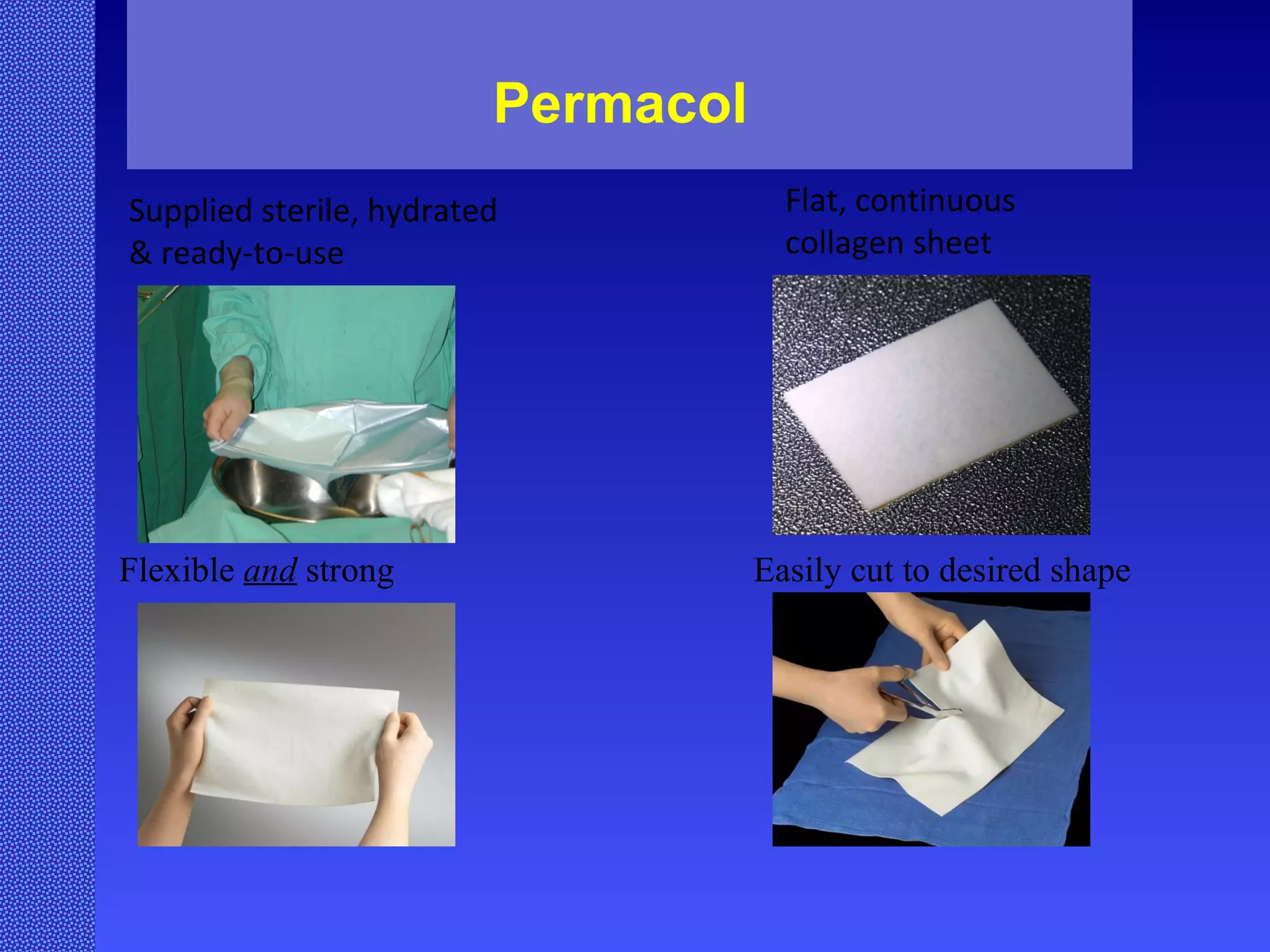 Permacol   Supplied sterile, hydrated & ready-to-use Flexible  and  strong Flat, continuous collagen sheet Easily cut to desired shape   