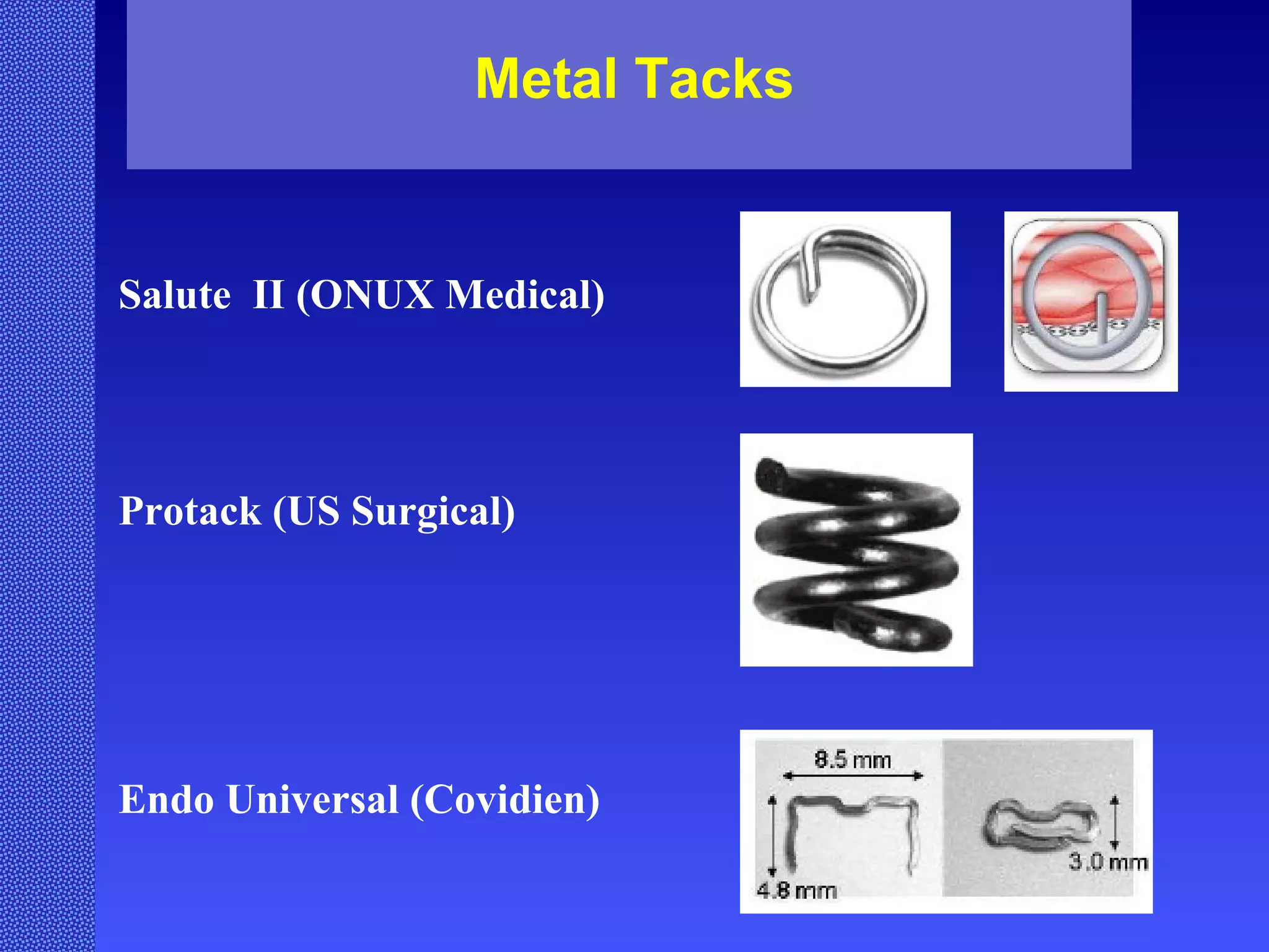Metal Tacks Salute  II (ONUX Medical) Protack (US Surgical) Endo Universal (Covidien) 
