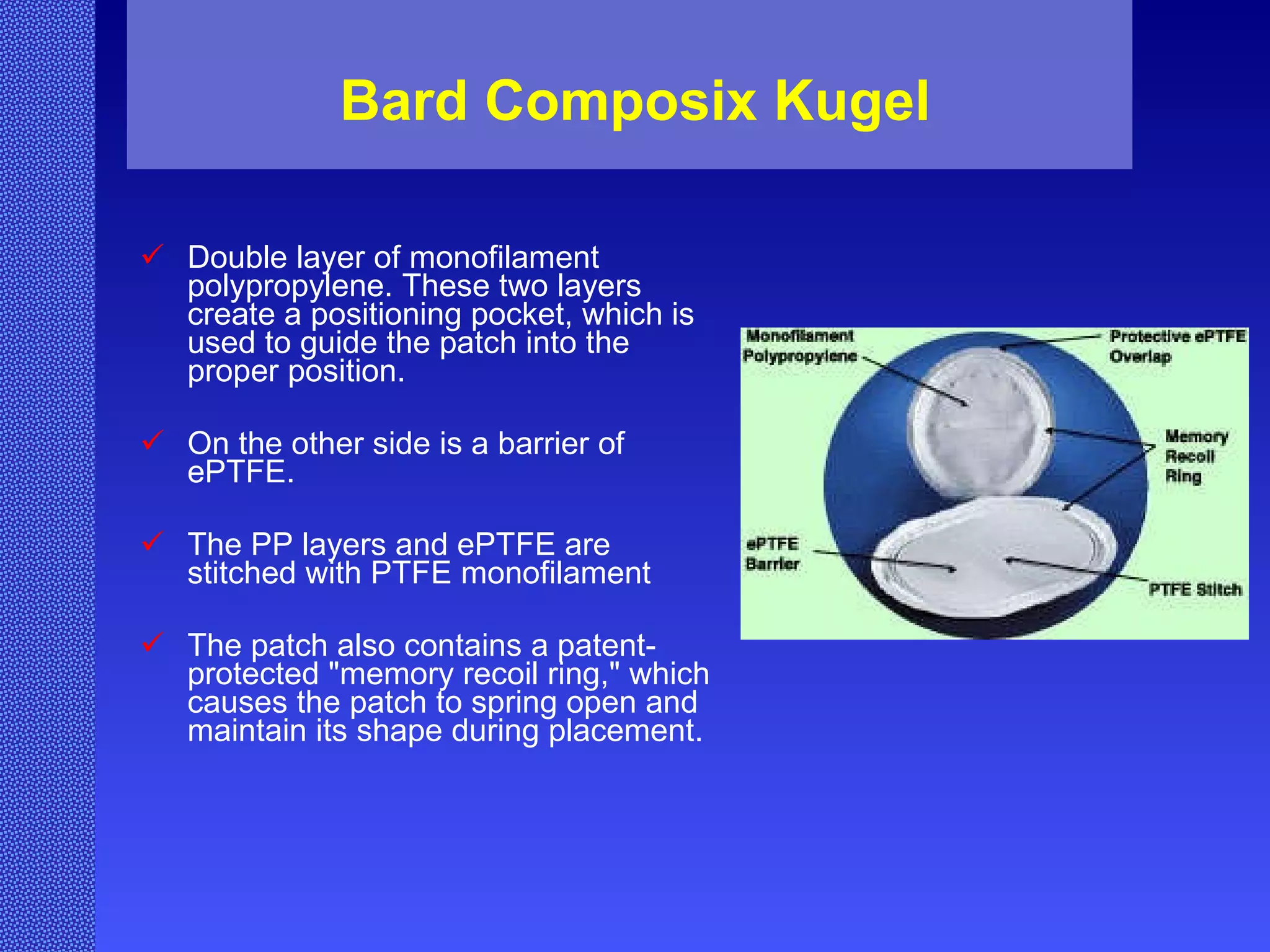 Bard Composix Kugel Double layer of monofilament polypropylene. These two layers create a positioning pocket, which is used to guide the patch into the proper position.  On the other side is a barrier of ePTFE.  The PP layers and ePTFE are stitched with PTFE monofilament The patch also contains a patent-protected "memory recoil ring," which causes the patch to spring open and maintain its shape during placement. 