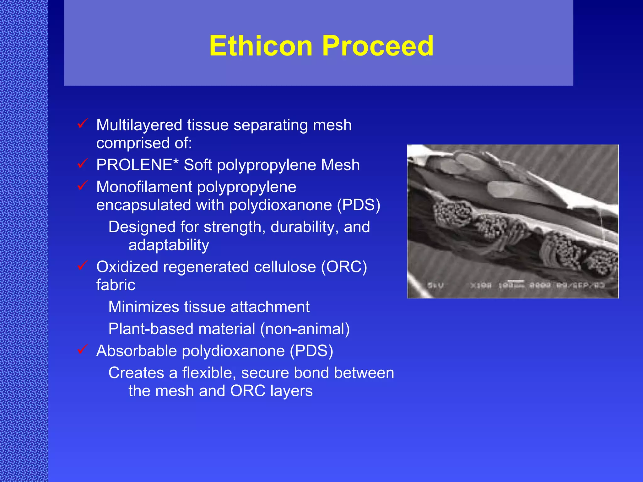 Ethicon Proceed Multilayered tissue separating mesh comprised of:  PROLENE* Soft polypropylene Mesh  Monofilament polypropylene encapsulated with polydioxanone (PDS) Designed for strength, durability, and adaptability  Oxidized regenerated cellulose (ORC) fabric Minimizes tissue attachment Plant-based material (non-animal)  Absorbable polydioxanone (PDS) Creates a flexible, secure bond between the mesh and ORC layers  