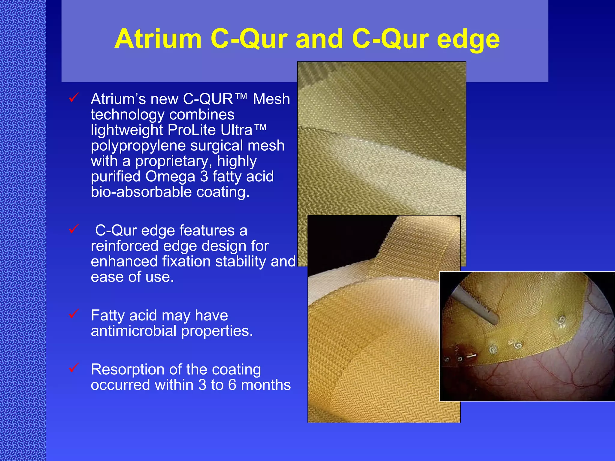 Atrium C-Qur and C-Qur edge Atrium’s new C-QUR™ Mesh technology combines lightweight ProLite Ultra™ polypropylene surgical mesh with a proprietary, highly purified Omega 3 fatty acid bio-absorbable coating. C-Qur edge features a reinforced edge design for enhanced fixation stability and ease of use. Fatty acid may have antimicrobial properties. Resorption of the coating occurred within 3 to 6 months 