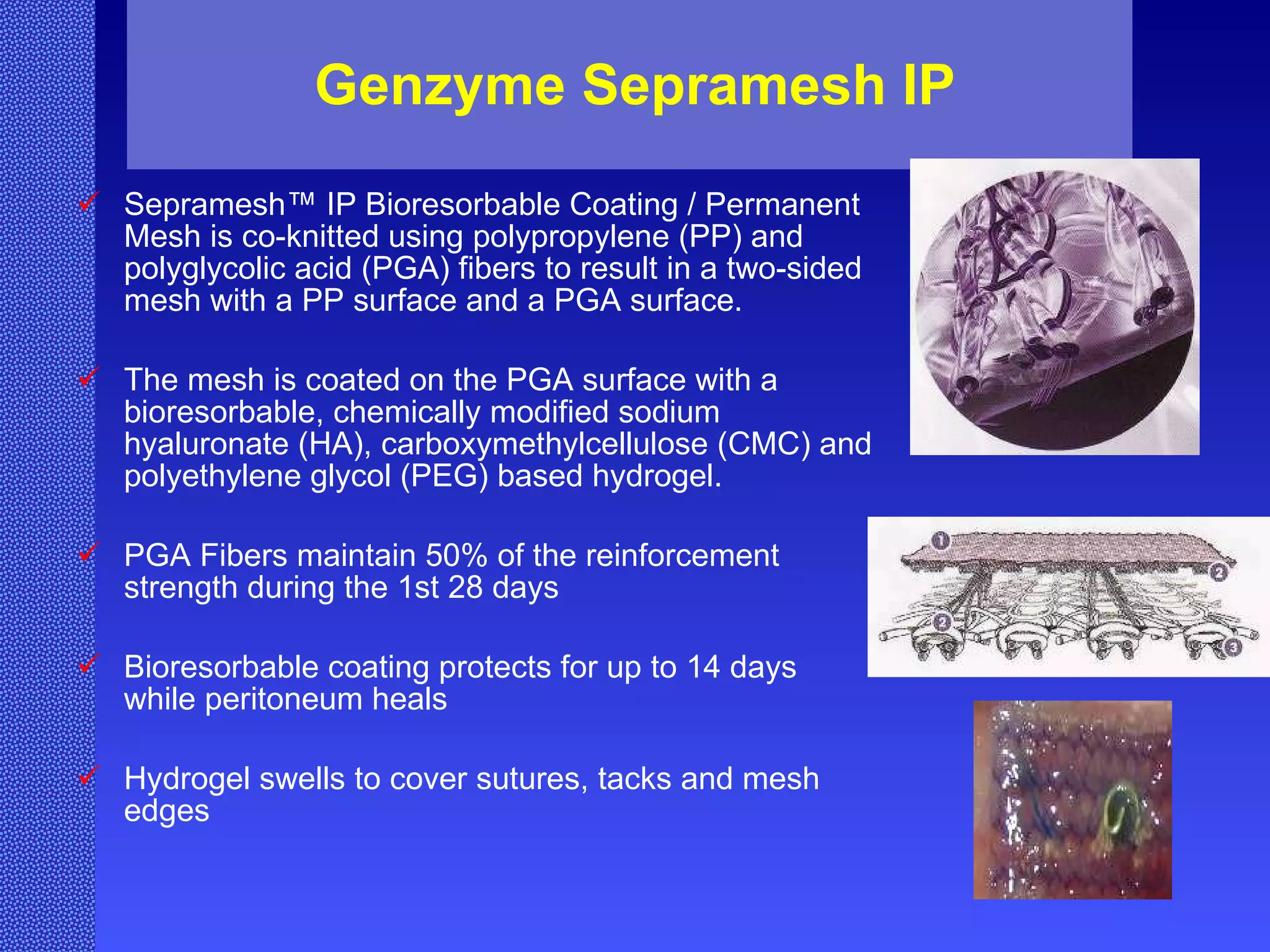 Genzyme Sepramesh IP Sepramesh™ IP Bioresorbable Coating / Permanent Mesh is co-knitted using polypropylene (PP) and polyglycolic acid (PGA) fibers to result in a two-sided mesh with a PP surface and a PGA surface.  The mesh is coated on the PGA surface with a bioresorbable, chemically modified sodium hyaluronate (HA), carboxymethylcellulose (CMC) and polyethylene glycol (PEG) based hydrogel. PGA Fibers maintain 50% of the reinforcement strength during the 1st 28 days Bioresorbable coating protects for up to 14 days while peritoneum heals Hydrogel swells to cover sutures, tacks and mesh edges 