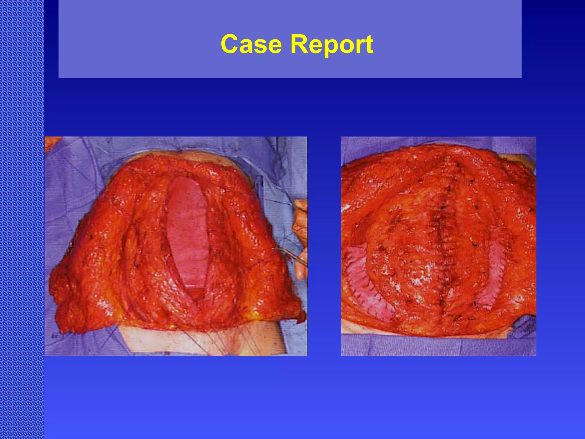 Case Report 