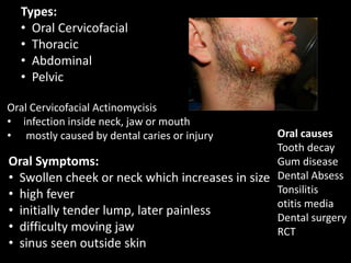 surgical non specific infection | PPTX