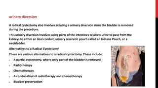surgical nutrition ppt 19.pptx