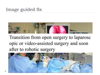 Image guided Sx
Transition from open surgery to laparosc
opic or video-assisted surgery and soon
after to robotic surgery
 