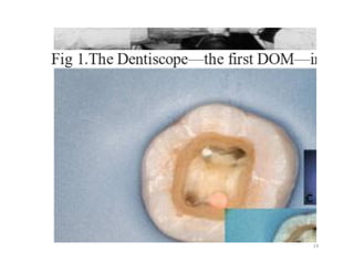 Surgical operationg microscope