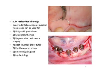 Surgical operationg microscope