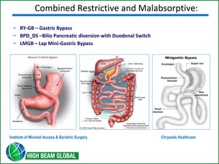 Combined Restrictive and Malabsorptive: 
– RY-GB – Gastric Bypass 
– BPD_DS –Bilio Pancreatic diversion with Duodenal Switch 
– LMGB – Lap Mini-Gastric Bypass 
Institute of Minimal Access & Bariatric Surgery Chrysalis Healthcare 
 