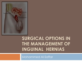 SURGICAL OPTIONS IN
THE MANAGEMENT OF
INGUINAL HERNIAS
Mohammed Al-Saffar
 