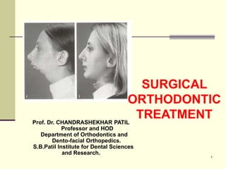 1
SURGICAL
ORTHODONTIC
TREATMENT
Prof. Dr. CHANDRASHEKHAR PATIL
Professor and HOD
Department of Orthodontics and
Dento-facial Orthopedics.
S.B.Patil Institute for Dental Sciences
and Research.
 