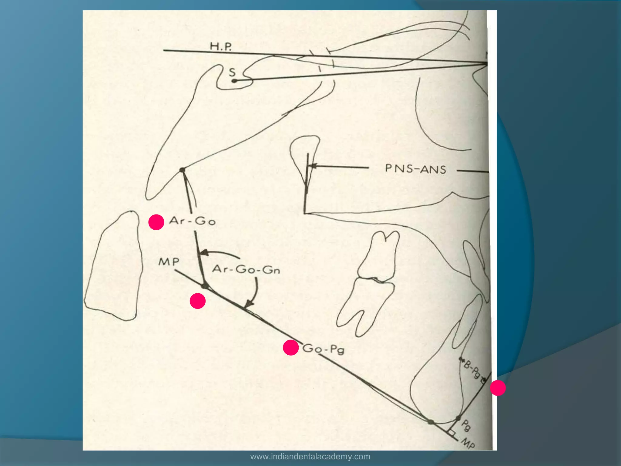 .
. .
.
www.indiandentalacademy.com
 