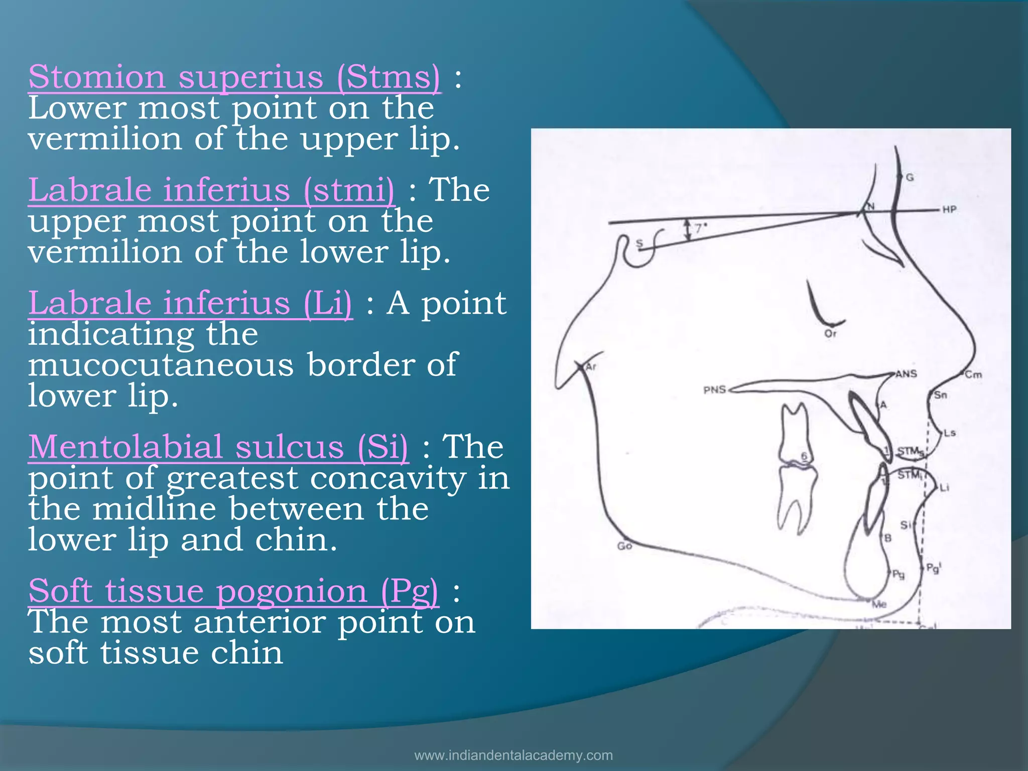 Stomion superius (Stms) :
Lower most point on the
vermilion of the upper lip.
Labrale inferius (stmi) : The
upper most point on the
vermilion of the lower lip.
Labrale inferius (Li) : A point
indicating the
mucocutaneous border of
lower lip.
Mentolabial sulcus (Si) : The
point of greatest concavity in
the midline between the
lower lip and chin.
Soft tissue pogonion (Pg) :
The most anterior point on
soft tissue chin
www.indiandentalacademy.com
 