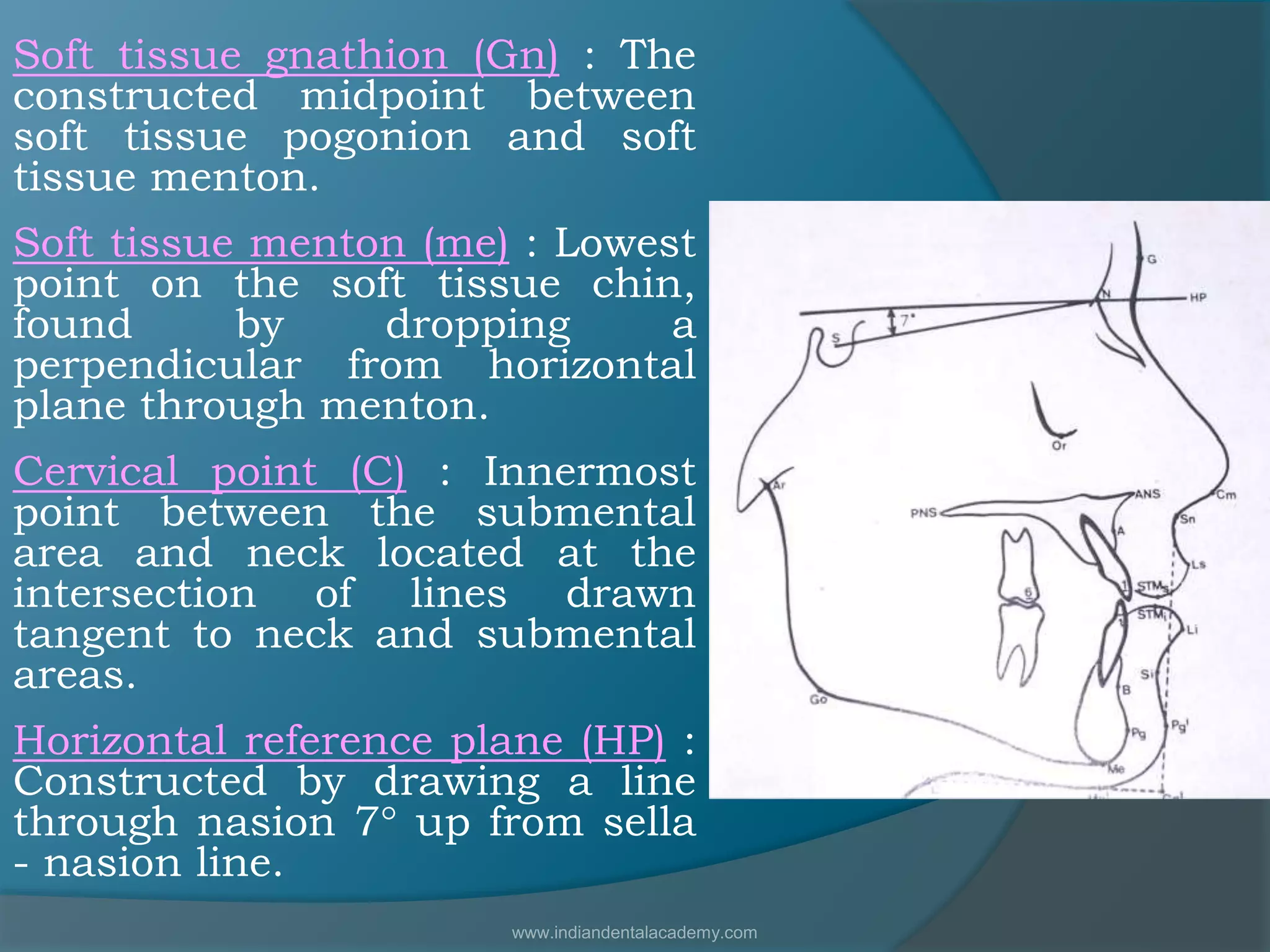 Soft tissue gnathion (Gn) : The
constructed midpoint between
soft tissue pogonion and soft
tissue menton.
Soft tissue menton (me) : Lowest
point on the soft tissue chin,
found by dropping a
perpendicular from horizontal
plane through menton.
Cervical point (C) : Innermost
point between the submental
area and neck located at the
intersection of lines drawn
tangent to neck and submental
areas.
Horizontal reference plane (HP) :
Constructed by drawing a line
through nasion 7° up from sella
- nasion line.
www.indiandentalacademy.com
 