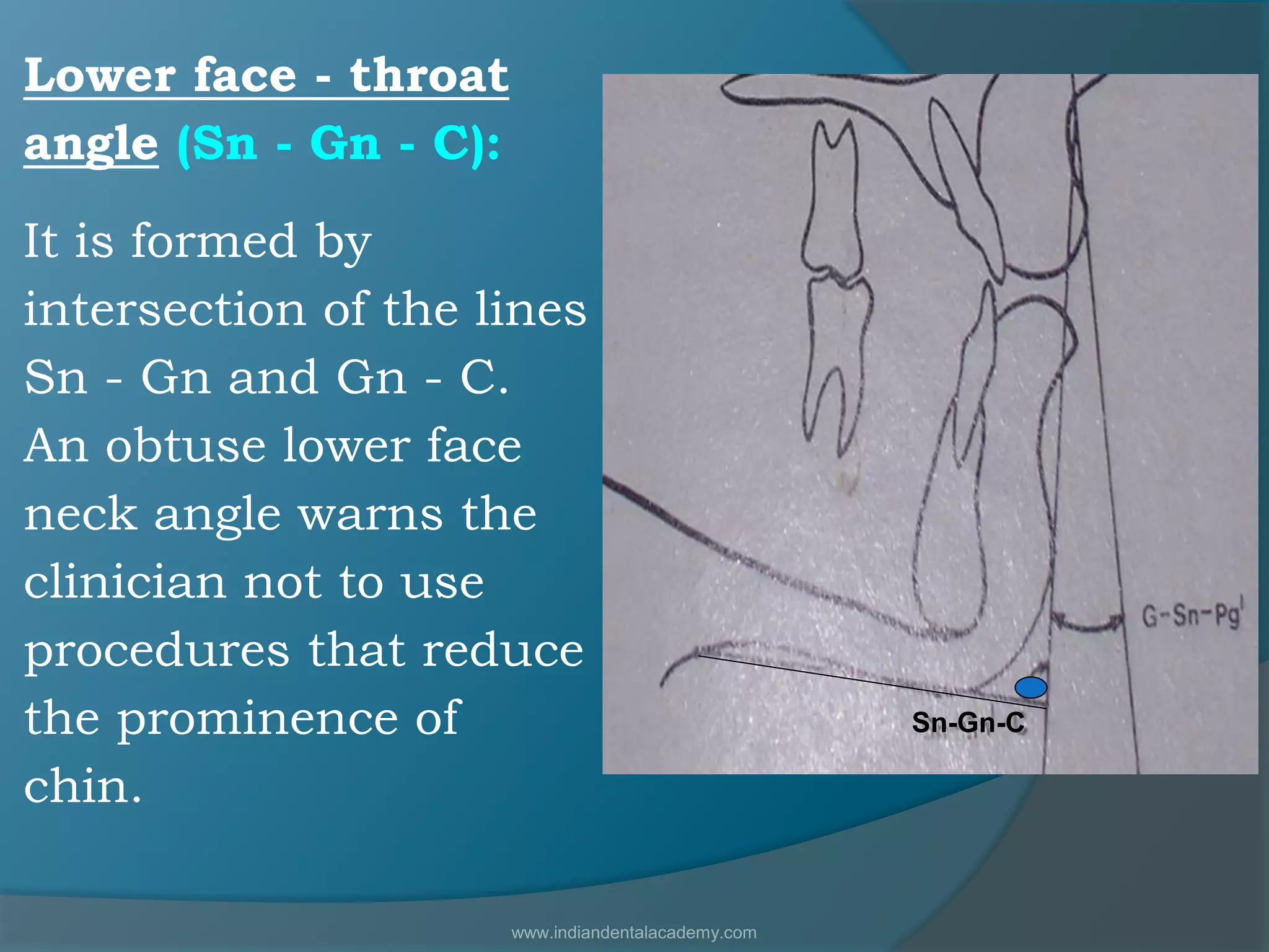 Lower face - throat
angle (Sn - Gn - C):
It is formed by
intersection of the lines
Sn - Gn and Gn - C.
An obtuse lower face
neck angle warns the
clinician not to use
procedures that reduce
the prominence of
chin.
Sn-Gn-C
www.indiandentalacademy.com
 