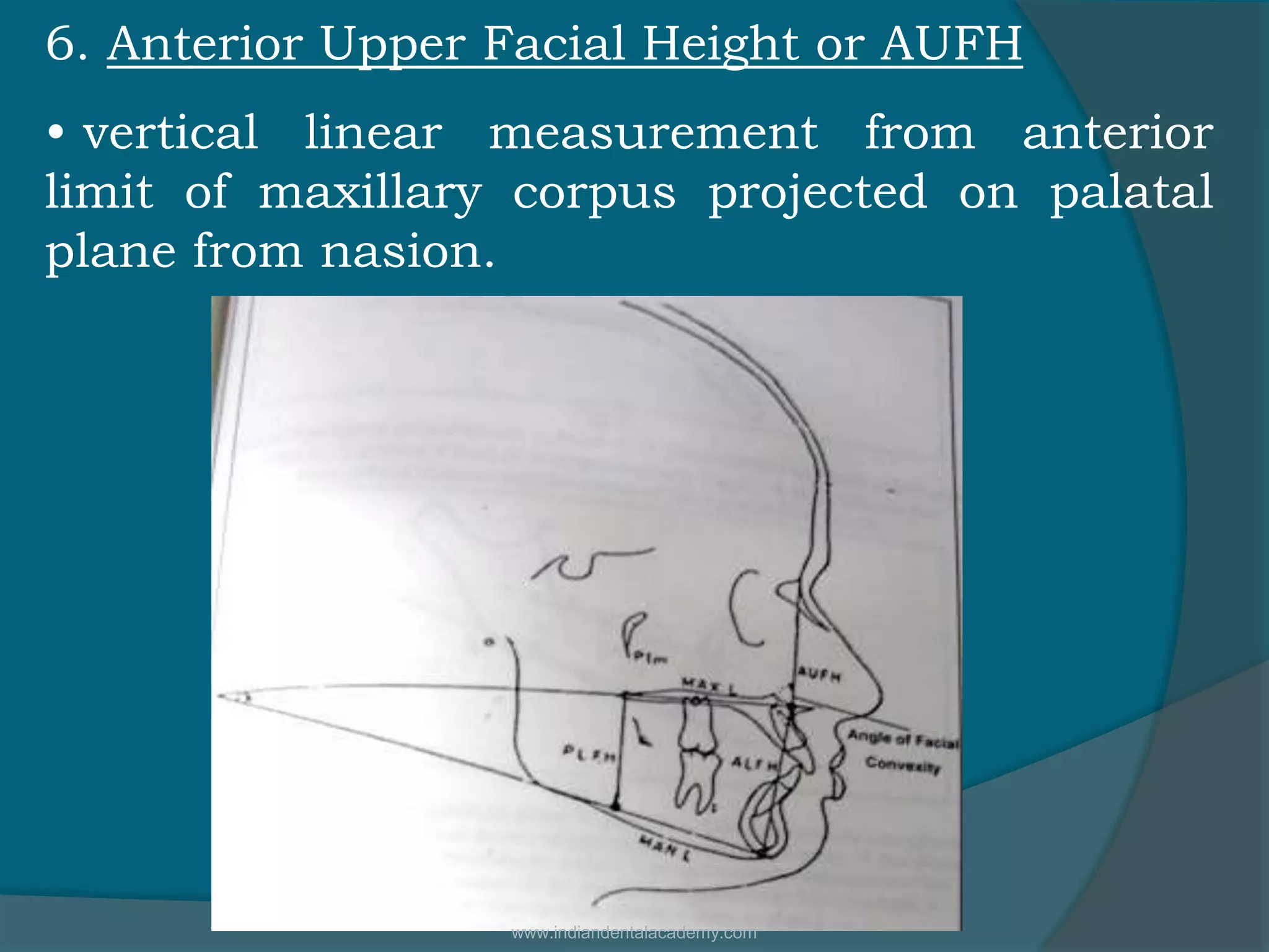 6. Anterior Upper Facial Height or AUFH
• vertical linear measurement from anterior
limit of maxillary corpus projected on palatal
plane from nasion.
www.indiandentalacademy.com
 