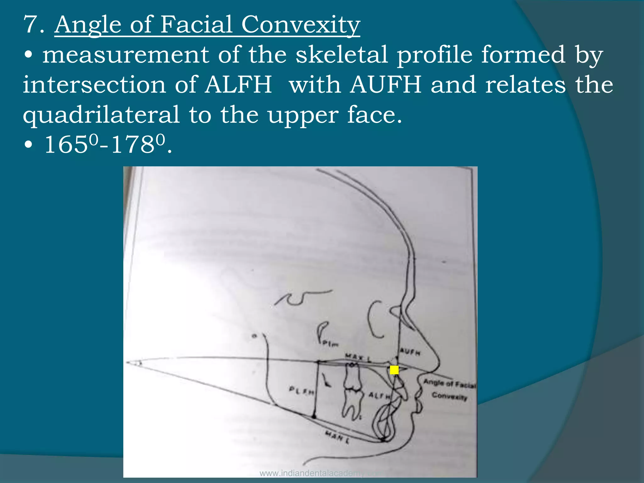 7. Angle of Facial Convexity
• measurement of the skeletal profile formed by
intersection of ALFH with AUFH and relates the
quadrilateral to the upper face.
• 1650-1780.
.
www.indiandentalacademy.com
 