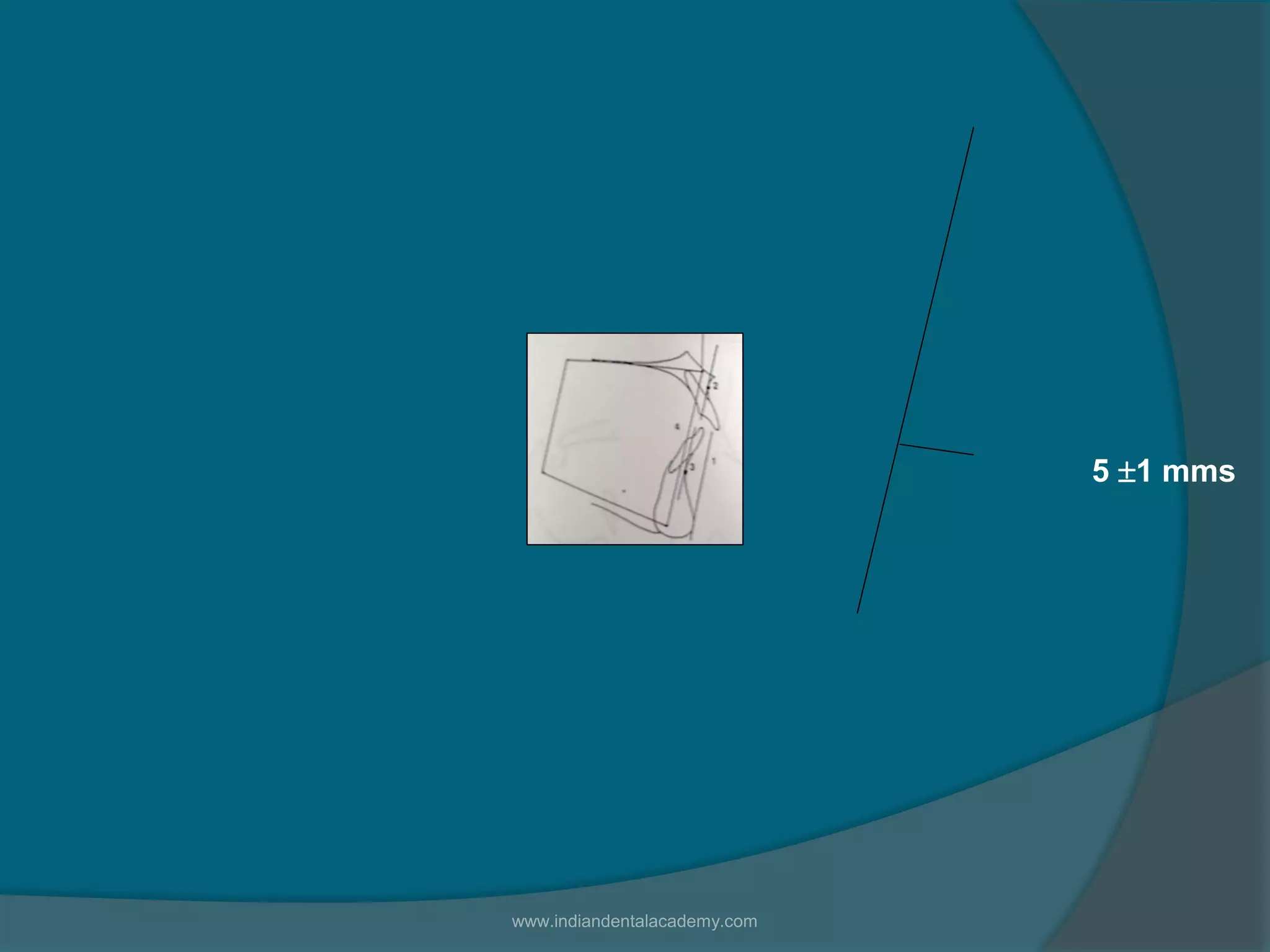 5 1 mms
www.indiandentalacademy.com
 