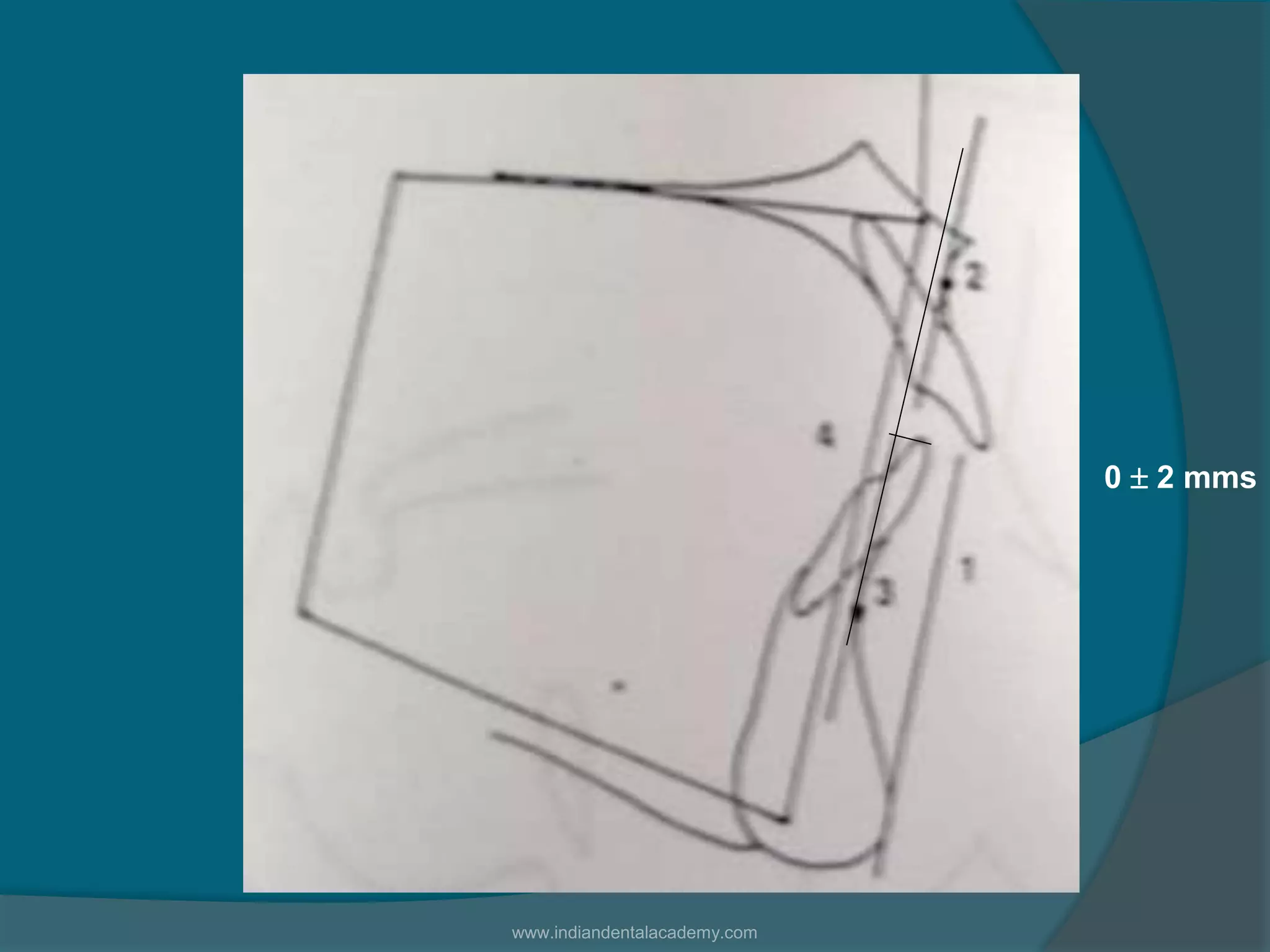 0  2 mms
www.indiandentalacademy.com
 