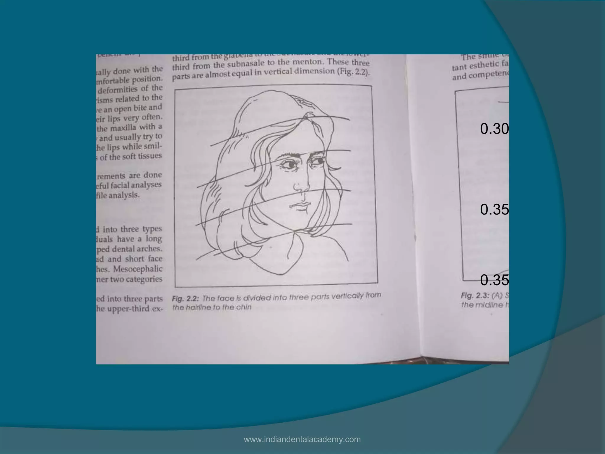 0.30
0.35
0.35
www.indiandentalacademy.com
 