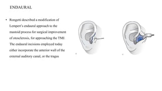 surgical part.pptx