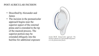 Postauricular Injection surgical part.pptx