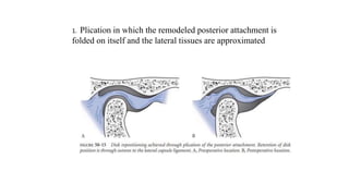 surgical part.pptx