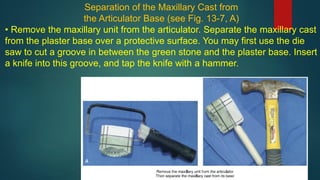 Separation of the Maxillary Cast from
the Articulator Base (see Fig. 13-7, A)
• Remove the maxillary unit from the articulator. Separate the maxillary cast
from the plaster base over a protective surface. You may first use the die
saw to cut a groove in between the green stone and the plaster base. Insert
a knife into this groove, and tap the knife with a hammer.
 