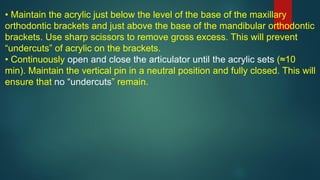 • Maintain the acrylic just below the level of the base of the maxillary
orthodontic brackets and just above the base of the mandibular orthodontic
brackets. Use sharp scissors to remove gross excess. This will prevent
“undercuts” of acrylic on the brackets.
• Continuously open and close the articulator until the acrylic sets (≈10
min). Maintain the vertical pin in a neutral position and fully closed. This will
ensure that no “undercuts” remain.
 