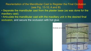 Reorientation of the Mandibular Cast to Register the Final Occlusion
(see Fig. 13-10, A and B)
• Separate the mandibular cast from the plaster base (as was done for the
maxillary cast).
• Articulate the mandibular cast with the maxillary unit in the desired final
occlusion, and secure the occlusion with hot glue.
 
