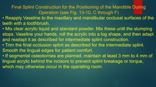 Final Splint Construction for the Positioning of the Mandible During
Operation (see Fig. 13-10, C through F)
• Reapply Vaseline to the maxillary and mandibular occlusal surfaces of the
teeth with a toothbrush.
• Mix clear acrylic liquid and standard powder. Mix these until the slumping
stops. Vaseline your hands, roll the acrylic into a log shape, and then adapt
and readapt it as described for intermediate splint construction.
• Trim the final occlusion splint as described for the intermediate splint.
Smooth the lingual edges for patient comfort.
• If segmental osteotomies are planned, maintain at least 3 mm to 4 mm of
lingual acrylic behind the incisors to prevent splint breakage or torque,
which may otherwise occur in the operating room.
 
