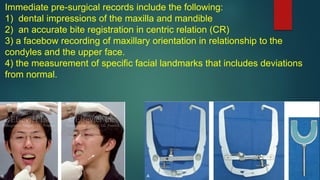 Immediate pre-surgical records include the following:
1) dental impressions of the maxilla and mandible
2) an accurate bite registration in centric relation (CR)
3) a facebow recording of maxillary orientation in relationship to the
condyles and the upper face.
4) the measurement of specific facial landmarks that includes deviations
from normal.
 