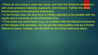 • Place an ear prong in each ear canal, and hold the temporal extensions
with even pressure medially, superiorly, and forward. Tighten the three
thumb screws of the temporal extensions.
• In the frontal view, the face bow is initially adjusted to be parallel with the
pupils and in proximity to the infraorbital rims.
• If the orbits are asymmetric (e.g., in a patient with hemifacial microsomia
or the Klippel–Feil anomaly), do not use the interpupillary line as a frontal
reference plane. Instead, use the NHP as the facial reference plane.
 