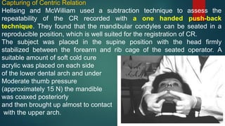 Capturing of Centric Relation
Hellsing and McWilliam used a subtraction technique to assess the
repeatability of the CR recorded with a one handed push-back
technique. They found that the mandibular condyles can be seated in a
reproducible position, which is well suited for the registration of CR.
The subject was placed in the supine position with the head firmly
stabilized between the forearm and rib cage of the seated operator. A
suitable amount of soft cold cure
acrylic was placed on each side
of the lower dental arch and under
Moderate thumb pressure
(approximately 15 N) the mandible
was coaxed posteriorly
and then brought up almost to contact
with the upper arch.
 