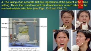 4. The taking of an accurate CR bite registration of the patient in the clinic
setting. This is then used to orient the dental models to each other on the
semi-adjustable articulator (see Figs. 13-2 and 13-4, C).
 