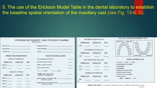 5. The use of the Erickson Model Table in the dental laboratory to establish
the baseline spatial orientation of the maxillary cast (see Fig. 13-6, C).
 
