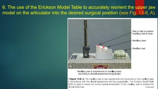 6. The use of the Erickson Model Table to accurately reorient the upper jaw
model on the articulator into the desired surgical position (see Fig. 13-8, A).
 