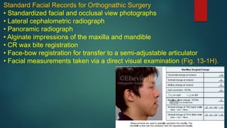 Standard Facial Records for Orthognathic Surgery
• Standardized facial and occlusal view photographs
• Lateral cephalometric radiograph
• Panoramic radiograph
• Alginate impressions of the maxilla and mandible
• CR wax bite registration
• Face-bow registration for transfer to a semi-adjustable articulator
• Facial measurements taken via a direct visual examination (Fig. 13-1H).
 