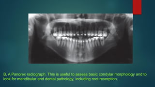 B, A Panorex radiograph. This is useful to assess basic condylar morphology and to
look for mandibular and dental pathology, including root resorption.
 