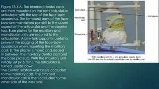 Figure 13-4 A, The trimmed dental casts
are then mounted on the semi-adjustable
articulator with the use of the face-bow
apparatus. The temporal arms of the face
bow are maintained parallel to the upper
aspect of the articulator and the counter
top. Base plates for the maxillary and
mandibular units are secured to the
articulation. A bite-fork support is useful to
prevent the sagging of the face-bow
apparatus when mounting the maxillary
cast. B, The plaster is mixed and added
in between the maxillary dental cast and
the base plate. C, With the maxillary unit
initially set (≈15 min), the articulator is
turned upside down.
The centric relation wax bite is occluded
to the maxillary cast. The trimmed
mandibular cast is then occluded to the
other side of the wax bite.
 