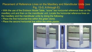 Placement of Reference Lines on the Maxillary and Mandibular Units (see
Fig. 13-5, A through E)
• With the use of the Erickson Model Table, “score” two horizontal reference lines on the
maxillary unit and then on the mandibular unit. Locate the horizontal reference lines on
the maxillary and the mandibular units by doing the following:
• Place the first horizontal line within the green stone.
• Place the second horizontal line within the white plaster.
 