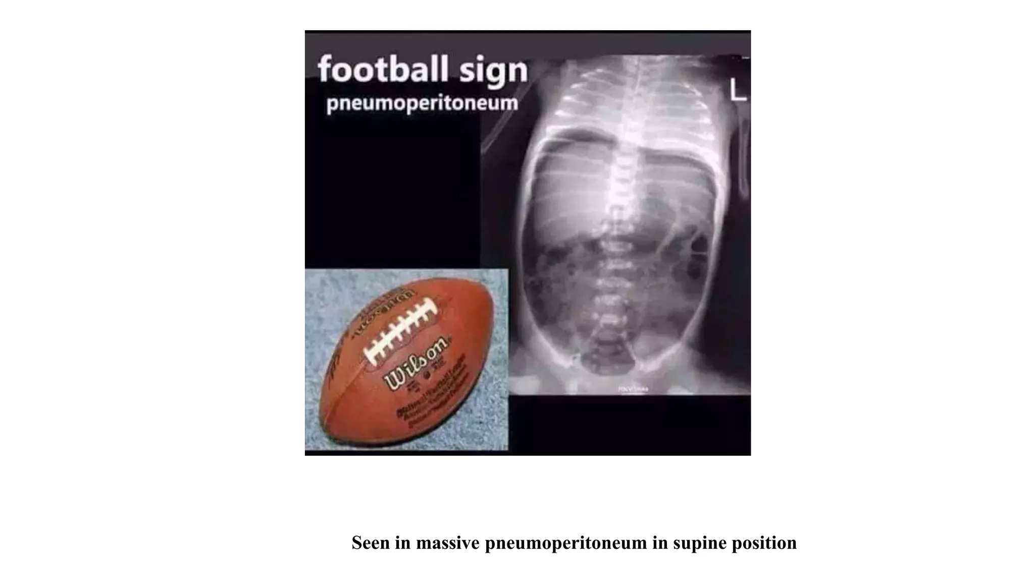 quick abdomen radiology review .pptx