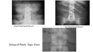 quick abdomen radiology review .pptx
