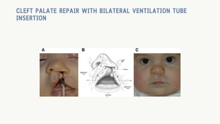 Surgical procedures & most used Sets.pdf