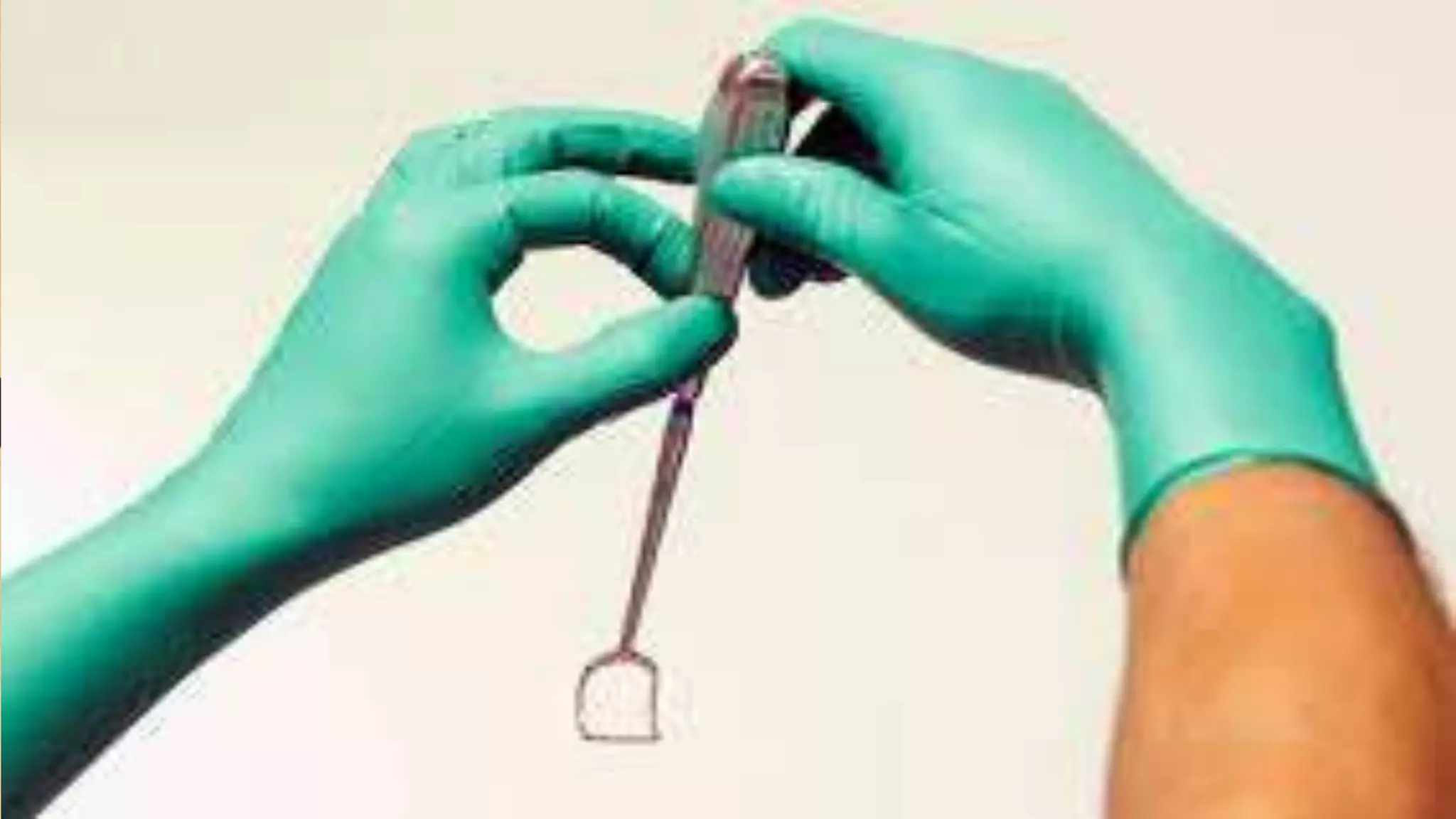 Pharynx Incision Surgical Procedures of the Pharynx | PPT