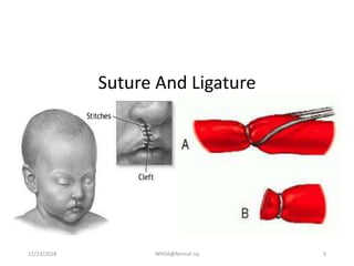 Suture And Ligature
12/23/2018 WHSA@Nirmal raj 3
 