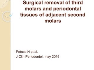 Surgical removal of third
molars and periodontal
tissues of adjacent second
molars
Petsos H et al.
J Clin Periodontol, may 2016
 