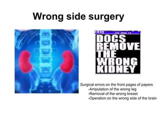 Wrong side surgery
Surgical errors on the front pages of papers
-Amputation of the wrong leg
-Removal of the wrong breast
-Operation on the wrong side of the brain
 