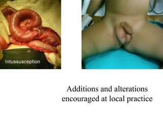 Additions and alterations
encouraged at local practice
 